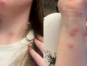 Caz revoltător în CFR! O tânără a ajuns direct la spital după ce a călătorit la cușetă. A plătit 190 de lei pe bilet