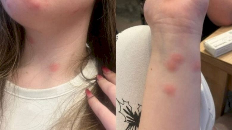 Caz revoltător în CFR! O tânără a ajuns direct la spital după ce a călătorit la cușetă. A plătit 190 de lei pe bilet