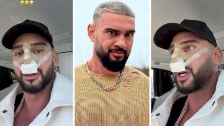 Ce problemă are Dorian Popa după operație. Prin ce trece: „Nu știu ce mi-a pus doctorul în nas” ⬇️