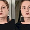 Cristina Buburuzanu, asistenta UPU, a murit într-un accident tragic! Soțul și fiul ei, în stare gravă