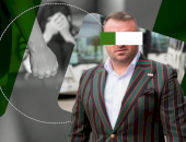 Milionarul și-a bătut iubita din cauza unor prăjituri! Cum își justifică rănile de pe față: ”Își face tot timpul operații estetice!”